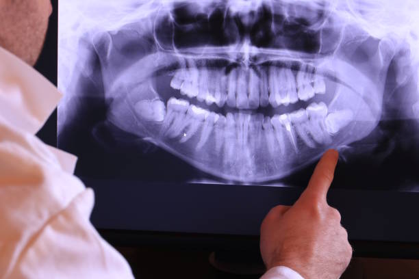 Best Emergency Tooth Extraction in Barre, VT