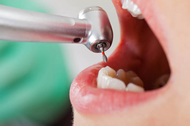 Best Pediatric Emergency Dentist in Barre, VT